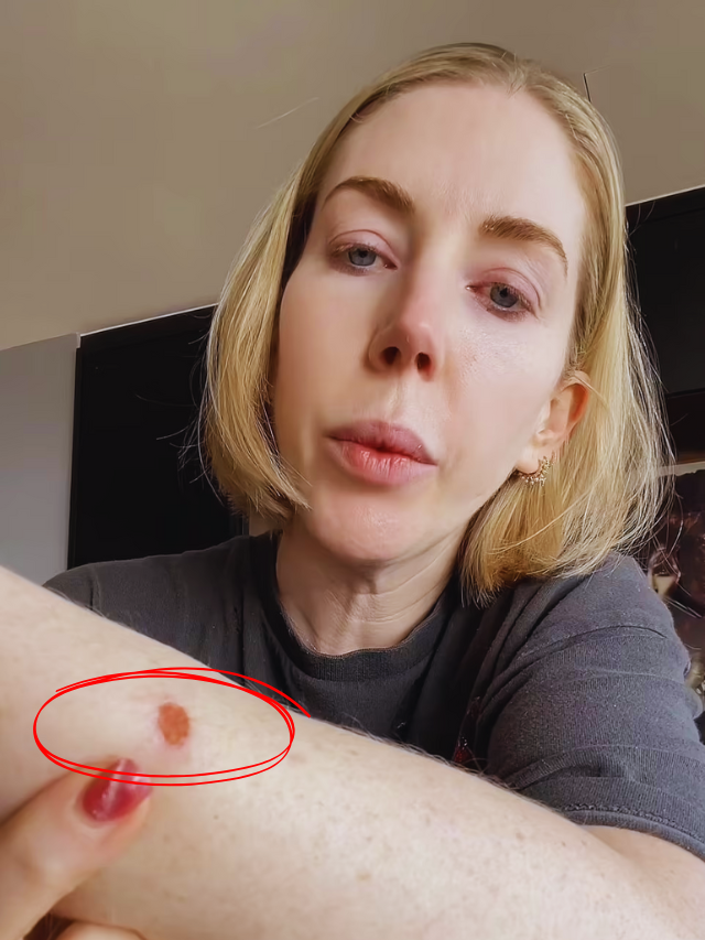 Katherine Ryan stunned by £6,000 bill for post-cancer blood test!